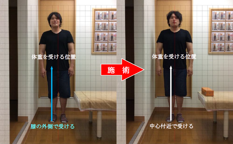 henkei_hizakansetu9