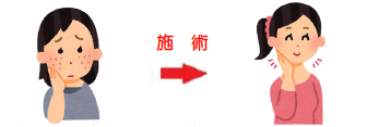 youtsu_sejyutu