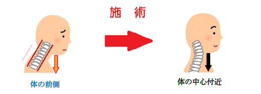 施術