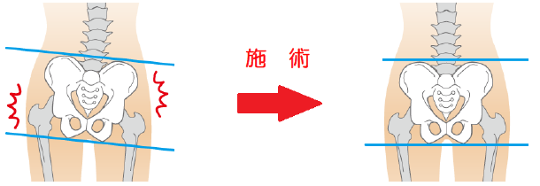 施術
