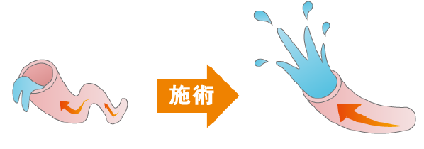 施術